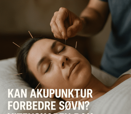 Kan akupunktur forbedre søvn? Vitenskapen bak – illustrasjon