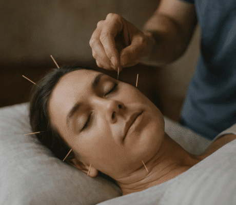 Slik kan akupunktur stotte immunforsvaret ditt featured